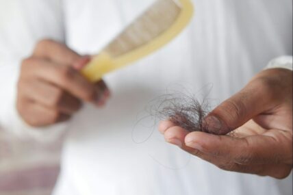 Woman holding clump of hair in hand.