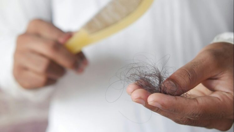 Woman holding clump of hair in hand.