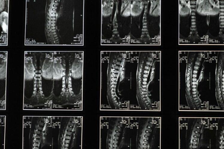 Spine x-ray
