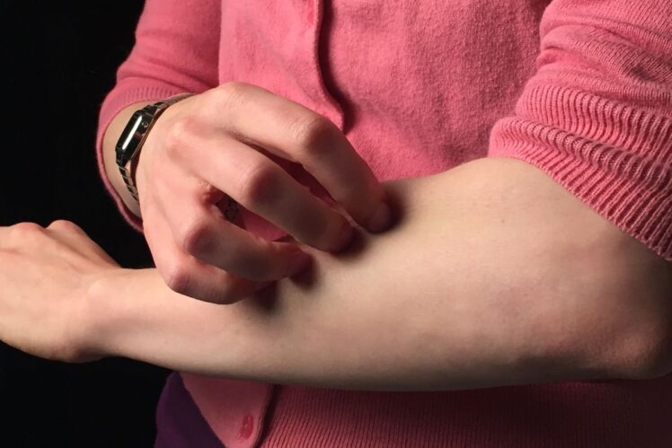 A woman scratches the skin on her forearm. 