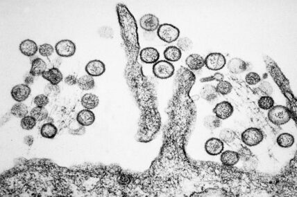Hantavirus under a microscope